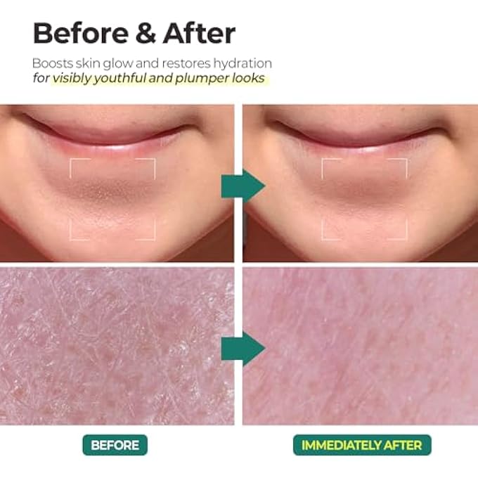 MOTHER MADE LHA GREEN TEA EXFOLIATING AQUA PEEL GEL, DEEP PORE FACE EXFOLIANT, GENTLE FACIAL EXFOLIATOR, DEAD SKIN REMOVER, NATURAL CELLULOSE FOR PEELING, VEGAN, KOREAN SKINCARE, 100 ML - Image 4